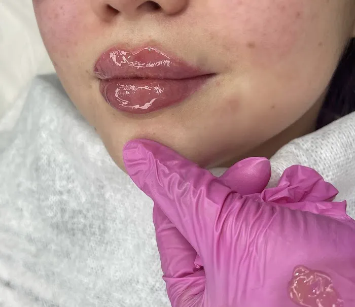 Mira aesthetics nyc 5