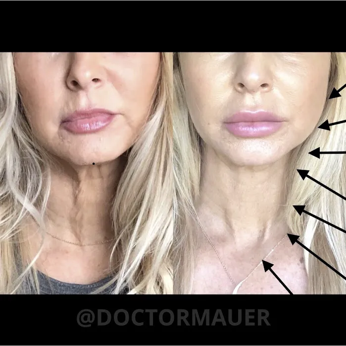 LaseRx Medical Aesthetic Center @DoctorMauer 5