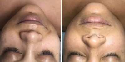SKIN BODY NUTRITION