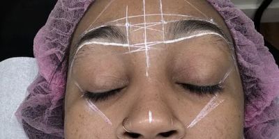 Innovation Laser Spa
