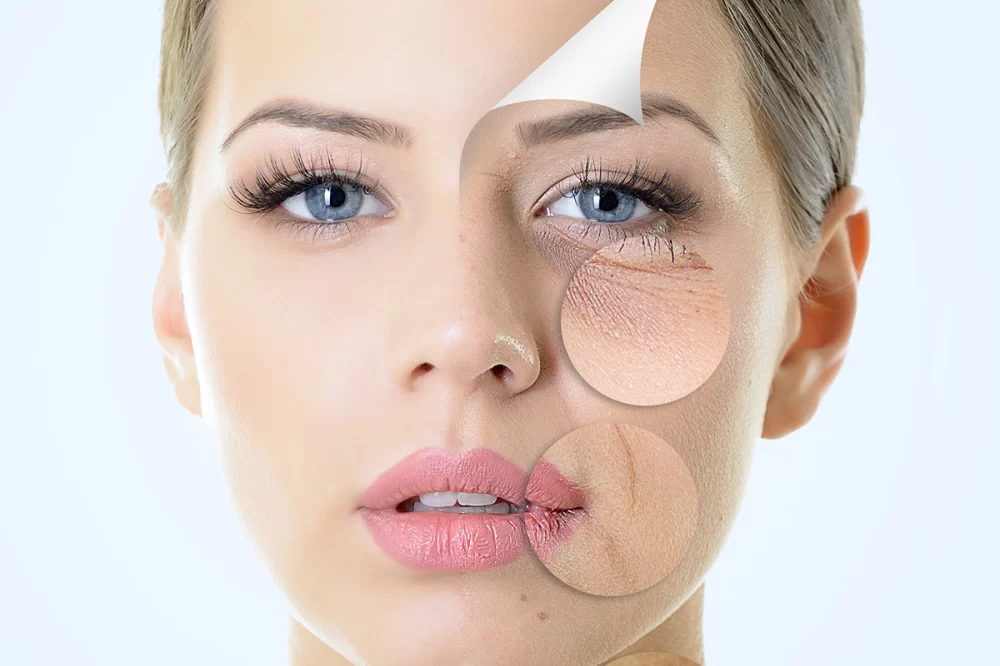 Benefits of Spa Treatments for Reducing Fine Lines: Rejuvenate Your Skin Naturally