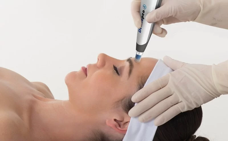 Best Spa Treatments for Scar Healing: What Really Works